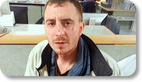Man claims LMPD officers broke his nose PHOTO